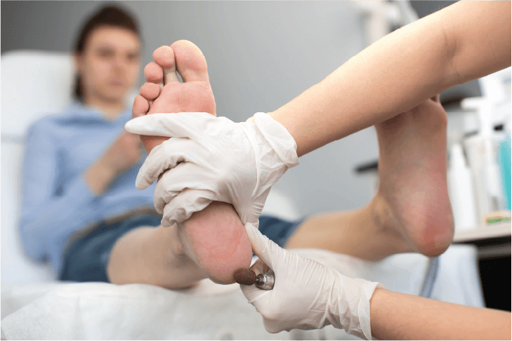 Diabetic Foot Care
